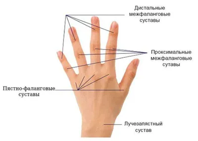 Подагра у мужчин: признаки, причины и лечение - статьи от компании Еламед