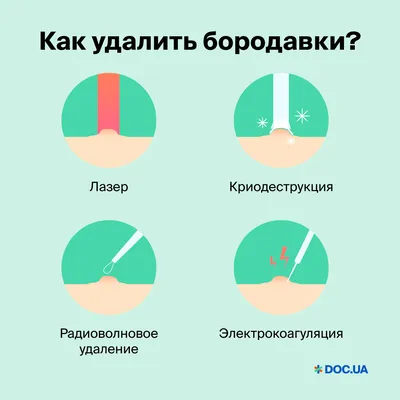 Вросший ноготь: что делать, причины, лечение без операции, осложнения,  профилактика