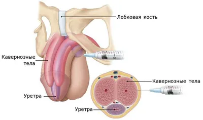 15 сантиметров – не приговор: врач-уролог назвал реальные методы увеличения полового  органа - Страсти