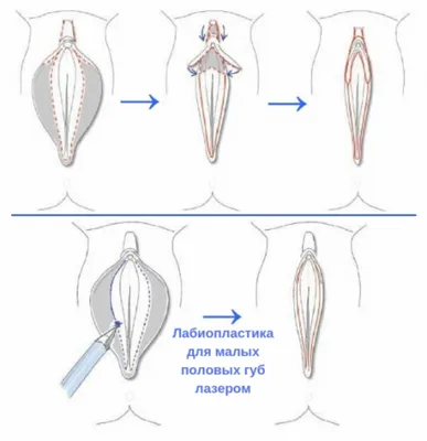 О половых губах | Доктор Елена Березовская