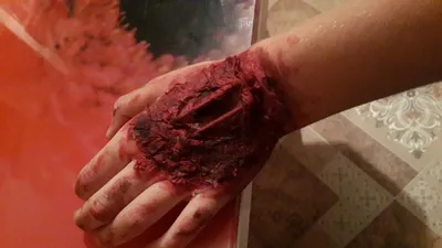 Ответы : Можно ли истечь кровью от нескольких глубоких порезав рук?  (Не запястий, а с тыльной стороны рук, как на фото?)