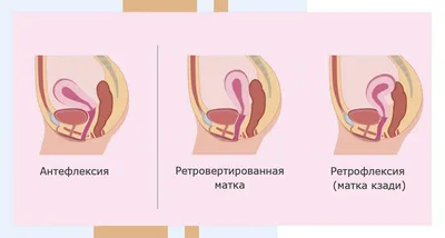 Какая поза лучше для зачатия ребенка: картинки и описание