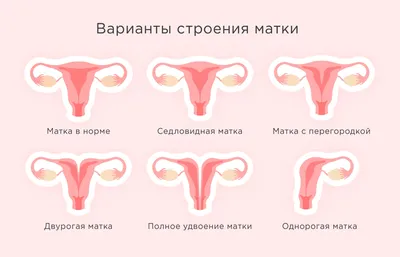 Патологии матки: как с ними забеременеть и родить?