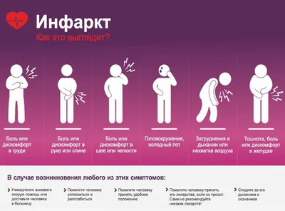 Инфаркт: Как это выглядит? | РКБ г. Реутов