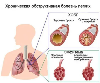 Про курильщиков картинки