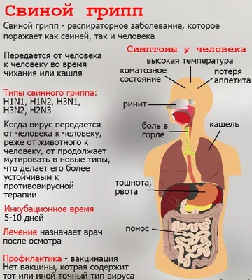 Файл:Symptoms of swine  — Википедия