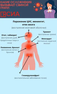 Свиной грипп? В Минздраве прокомментировали смерть пятилетнего ребенка - |  