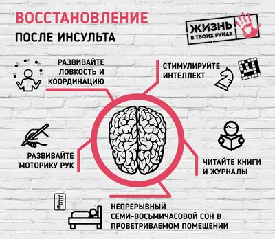 Памятка по профилактике инсульта | БУЗ ВО "ВОЛОГОДСКАЯ ГОРОДСКАЯ БОЛЬНИЦА  №2"