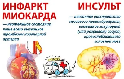 Всемирный День борьбы с инсультом  г. – СПБГБУЗ "Городская  поликлиника №37"