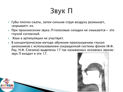 Почему сначала обязательно гласные👆 И только потом постановка дефектных  согласных | Логопед дает совет | Дзен