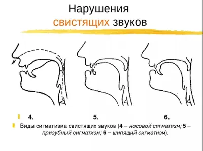 PDF) Сопоставительное МРТ-исследование артикуляционных моделей гласных  звуков в разных языках Contrastive MRI investigation of articulatory  patterns in different languages