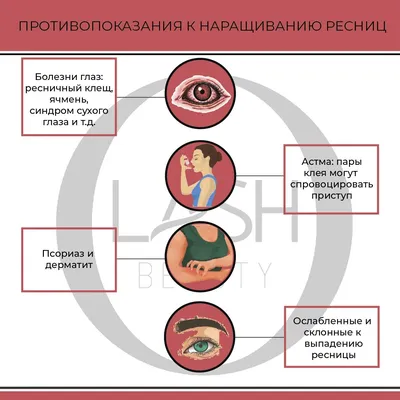 Противопоказания к наращиванию ресниц | Рекомендации