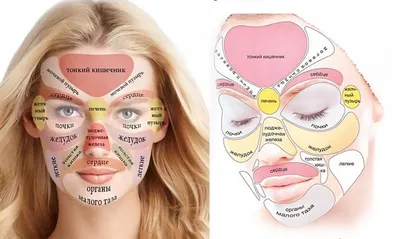 Прыщи на лице - признак заболевания внутренних органов. Большая статья с  ссылками на материалы | Ангелина Сахарова | Дзен