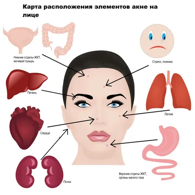 Прыщи на лице картинки