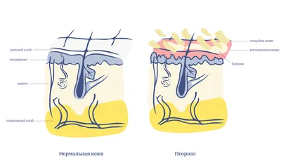 Фото: Псориаз-Центр, медцентр, клиника, Лесная ул., 49/1, Москва — Яндекс  Карты