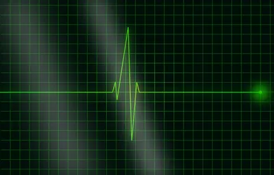 Сердечная норма. Как учащённый пульс влияет на риск смерти