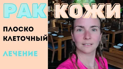 Базальноклеточный рак кожи (базалиома) | Клиника АЛОДЕРМ , Москва