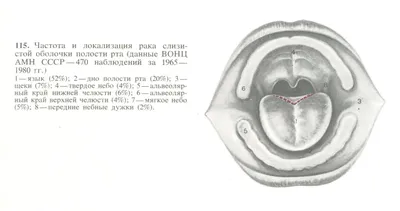Язык за зубами: рак полости рта южноуральцы замечают уже на последней  стадии -  - 