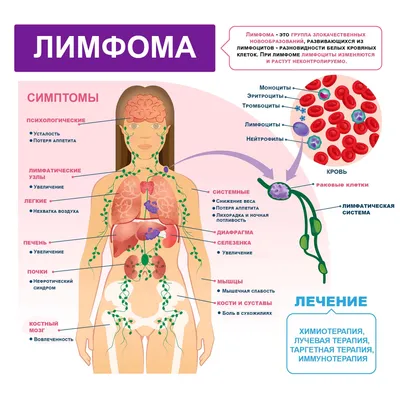 Симптомы, признаки и лечение ВИЧ-инфекции у женщин и мужчин — Медюнион