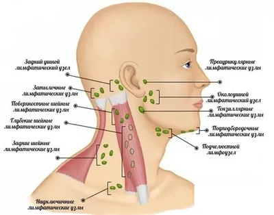 Лимфатические узлы на теле человека: где находятся, какие функции  выполняют, при каких болезнях увеличиваются
