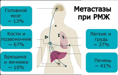 О чем говорит увеличение лимфоузлов? — ГБУЗ "Республиканский онкологический  диспансер"