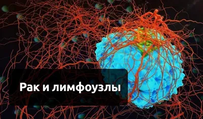 Лимфедема (лимфостаз): симптомы, причины, диагностика, чем опасна, цены на  лечение лимфедемы