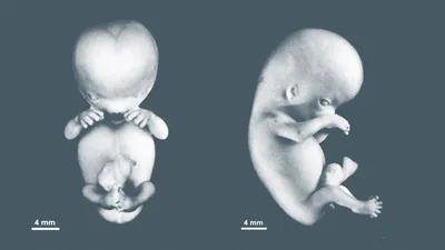 Этапы Развития Эмбриона Эмбриология Эмбриогенез Сперматозоид Яйцеклетка  Оплодотворенной Яйцеклеткой Бластоциста стоковое фото ©lightsource 662394822