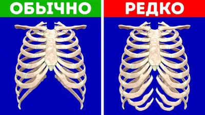 Могут ли сломаться рёбра во время СЛР? | Онлайн-школа первой помощи №1 |  Дзен