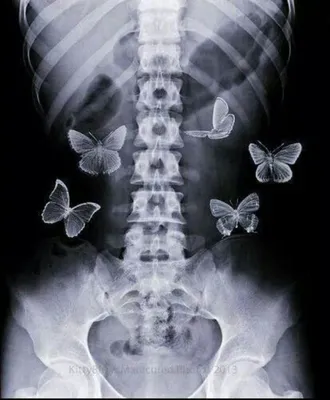 С бабочками в животе картинки