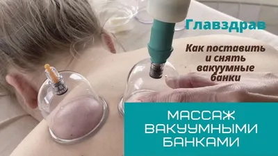 Массаж вакуумными банками. Как поставить и снять банки. - YouTube