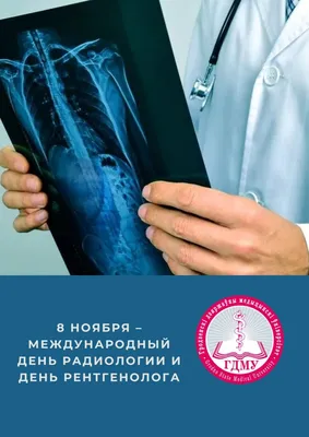 Новость День Рентгенолога