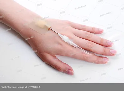 Женская рука с капельницей на кровати крупным планом :: Стоковая фотография  :: Pixel-Shot Studio