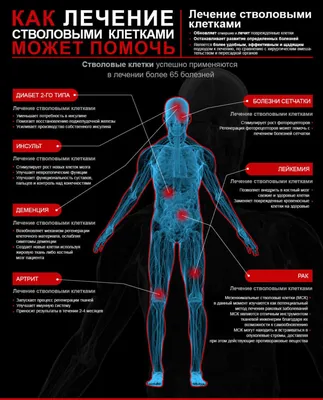 Что такое стволовые клетки? Что такое биострахование стволовыми клетками?  Какие болезни лечат стволовыми клетками?