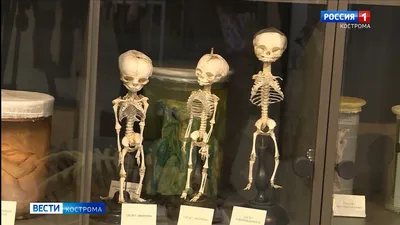В Костроме открывается своя «кунсткамера» со скелетами | ГТРК «Кострома»