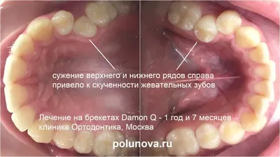 7 правил ухода за зубами, чтобы сохранить здоровые зубы.