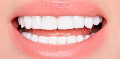 Гигиенические правила ухода за зубами - какие существуют правила ухода за  зубами