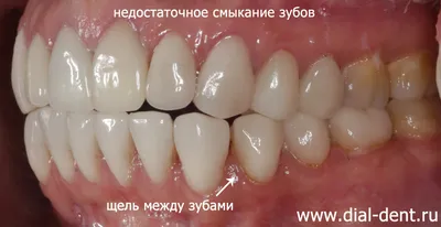 Основные проблемы с зубами: диагностика и лечение - Канадский центр  инновационной стоматологии и нейромышечной терапии