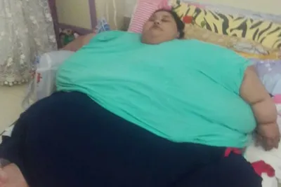 Самая толстая женщина в мире похудела на 250 килограмм за 2 месяца