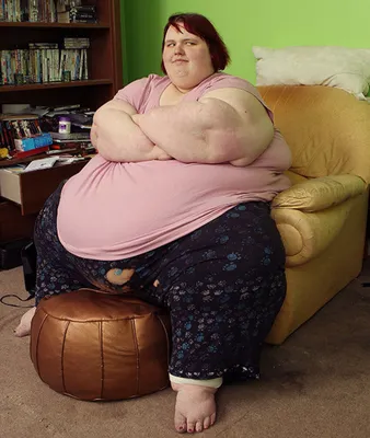 Самая толстая девушка Британии: «Я не могу выбраться из этого кресла!»