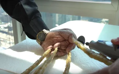 Женщина с самыми длинными ногтями в мире подстригла их впервые за 28 лет:  Люди: Из жизни: 