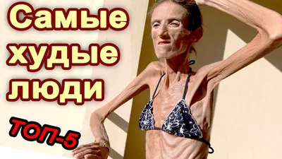 Самые худые мужчины мира | Вечно на диете | Дзен