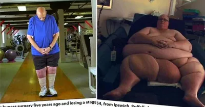Самый толстый человек в мире похудел ради любимой на 305 кг - 