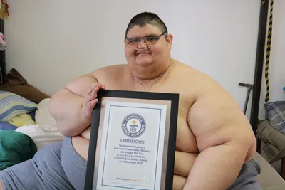 Самый толстый человек в мире умер, пытаясь похудеть - ТАСС