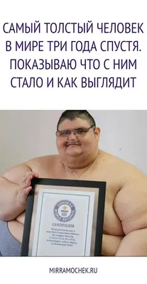 Самый худой человек в мире