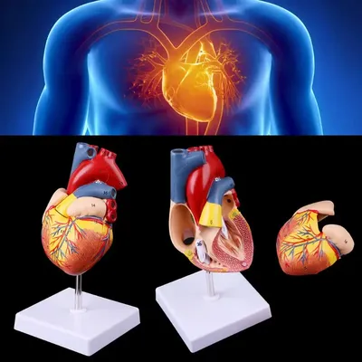 Сердце : нормальная анатомия | e-Anatomy