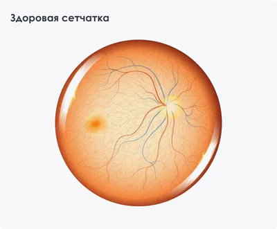 Структура сетчатки человеческого глаза и распространенные заболевания