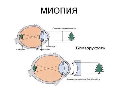 Сетчатка глаза - патология сетчатки: симптомы, диагностика и лечение  заболеваний сетчатки -  - сайт офтальмологического центра  "МГК-Диагностик"