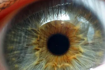 Виды и формы заболеваний сетчатки глаза | Хирургия глаза