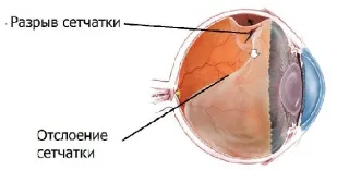 Сетчатка — Википедия