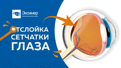 Лечение сетчатки глаза в Москве - Методы лечения